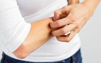 Il prurito può essere indicato come il primo segno della malattia